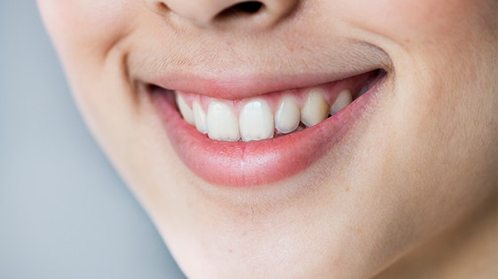 Dentisterie Esthetique