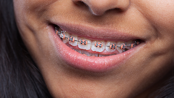 Orthodontie